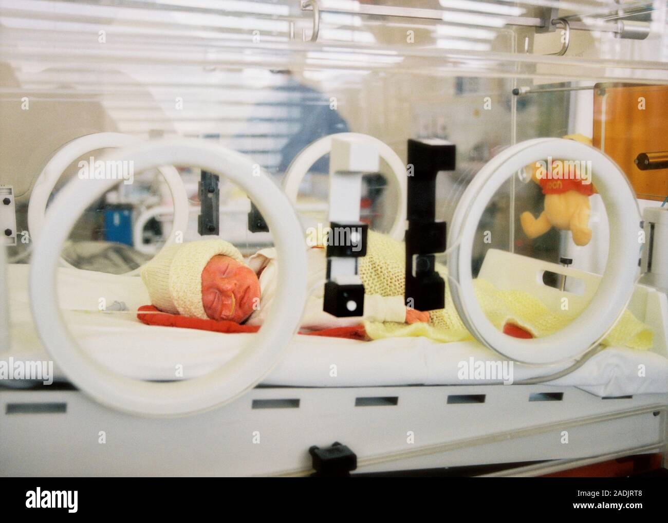 Premature baby in an incubator. Babies born before 37 weeks of