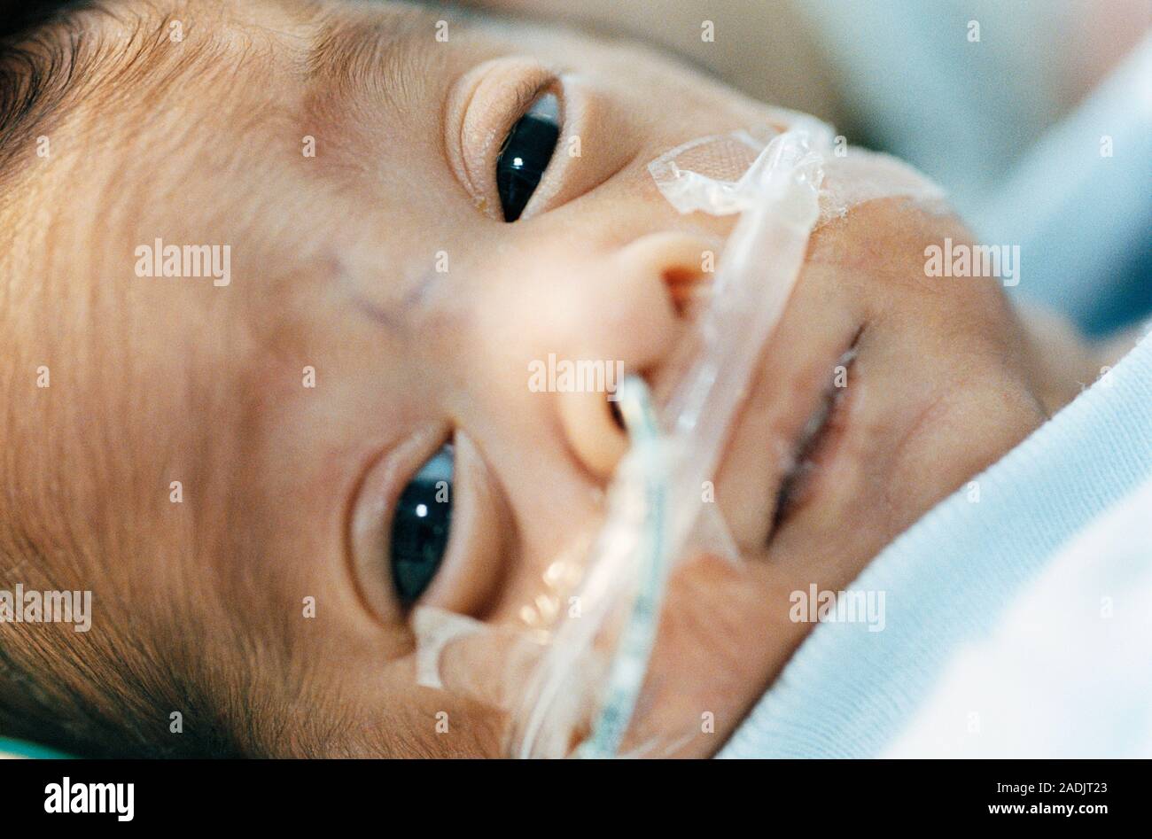 MODEL RELEASED. Premature baby. Five week old premature baby with
