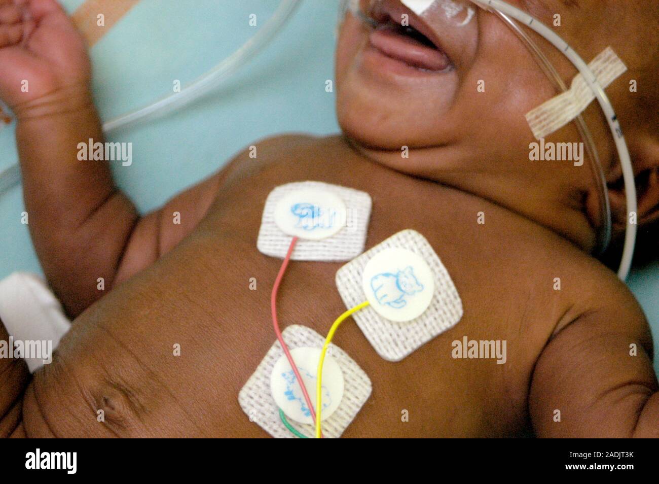MODEL RELEASED. Premature baby monitoring. This baby's heartbeat is