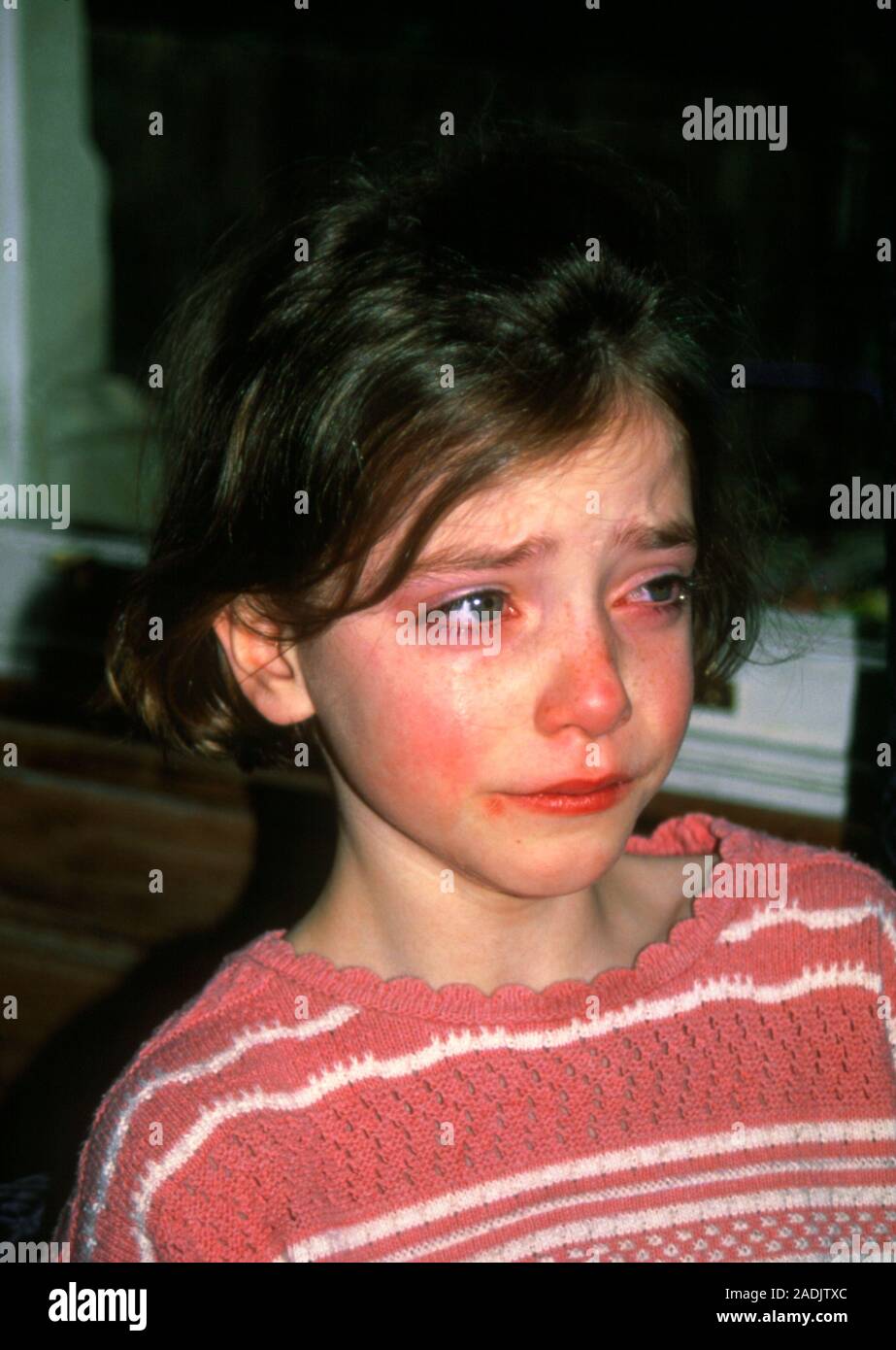 Crying. An eight yearold girl crying. The child's eyes are red and