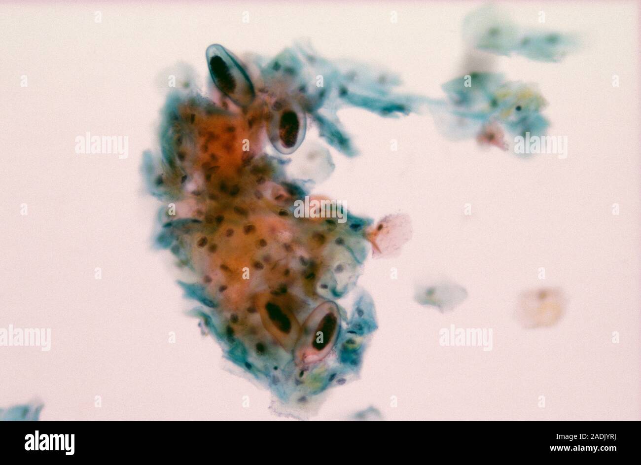Threadworm eggs. Light micrograph of a cervical smear containing four ...