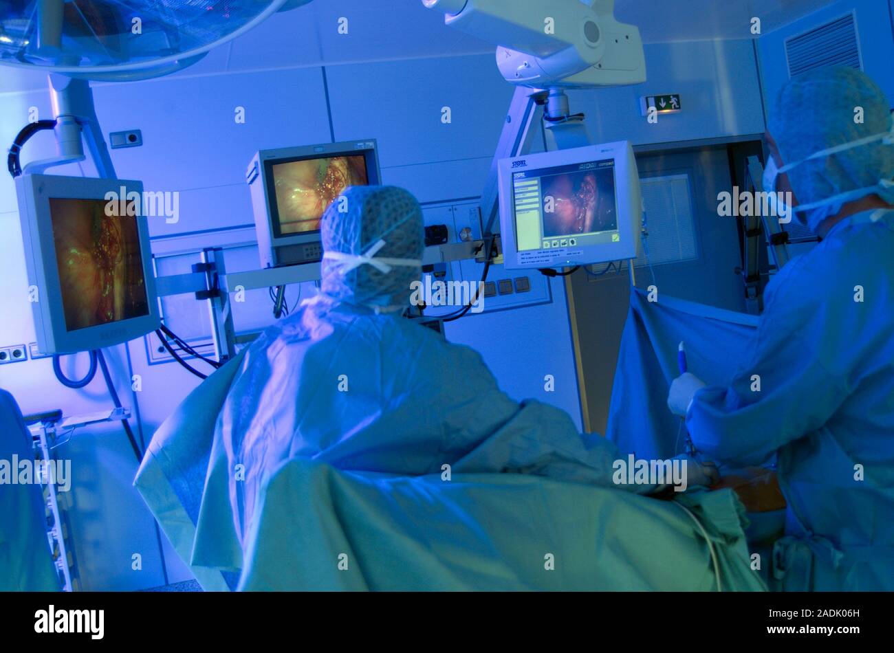 Ovarian cyst removal. Surgeons looking at the displays on screens ...