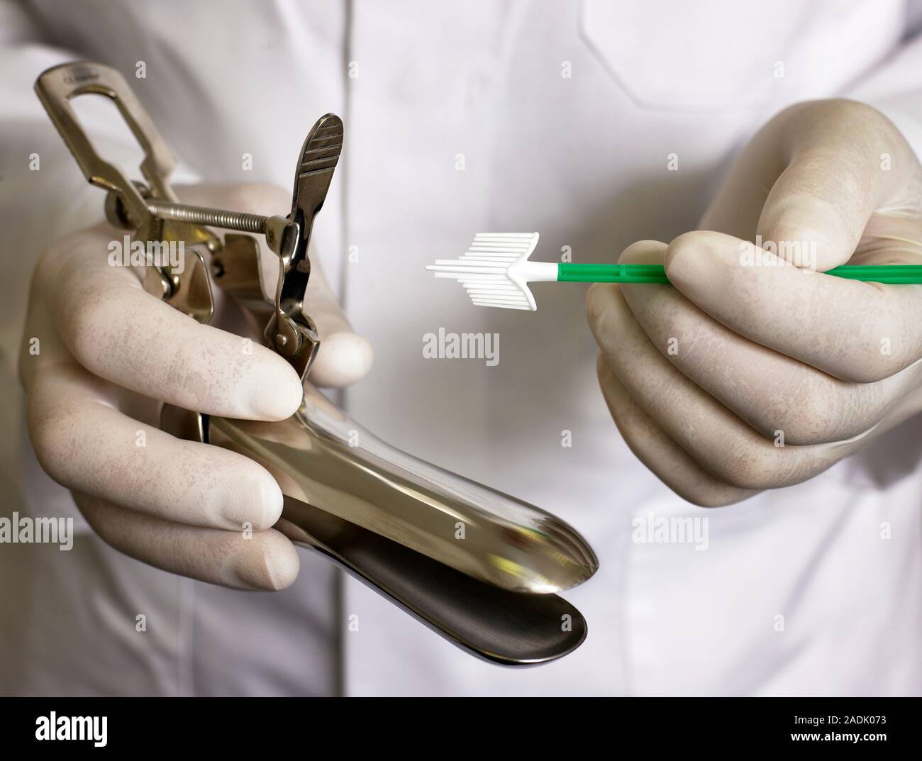 Smear test equipment. Doctor holding a duckbilled speculum (left) and