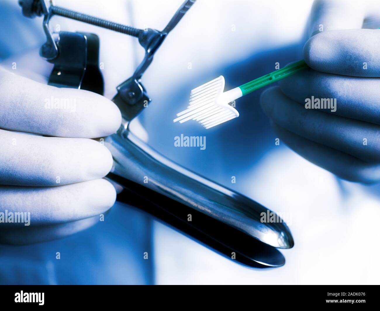 Smear test equipment. Closeup of a doctor holding a duckbilled