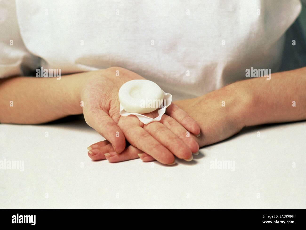 Contraception. View of a contraceptive sponge which is used to prevent