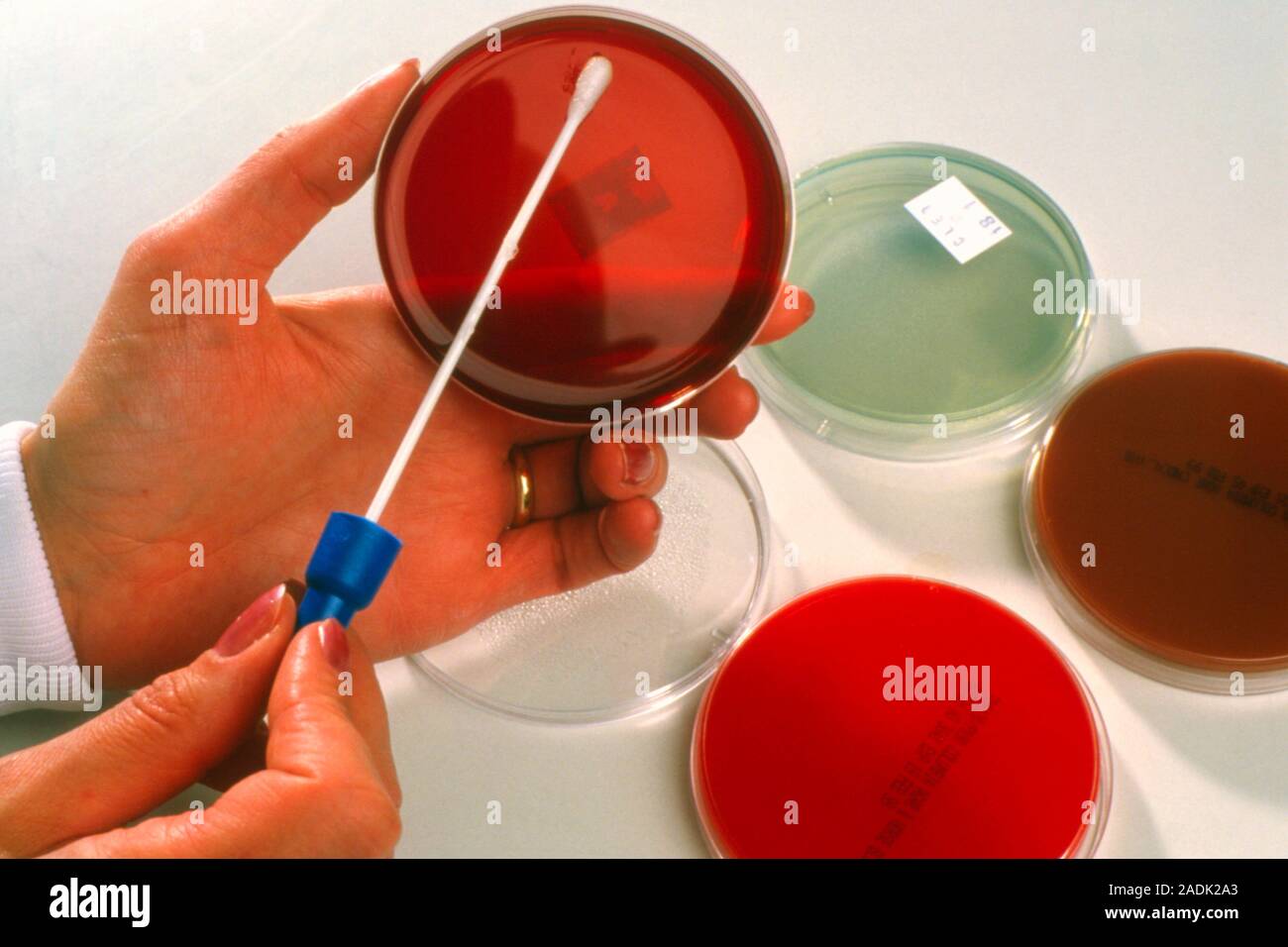 Vaginal bacteria culturing. Hand wiping a vaginal swab across a petri