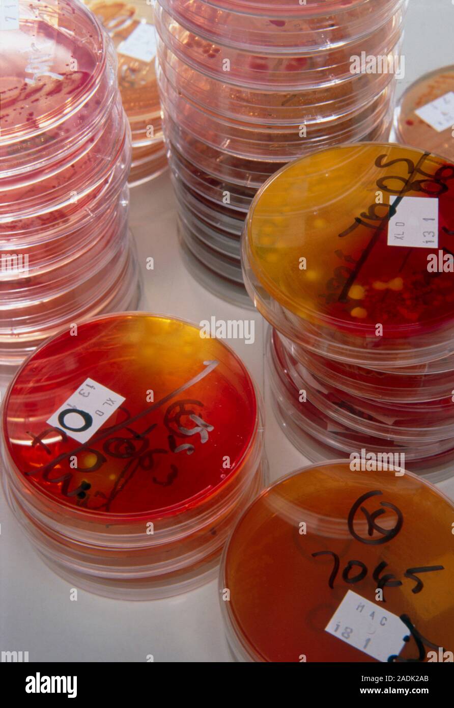 Faecal bacteria culturing. Stacks of petri dishes containing faecal