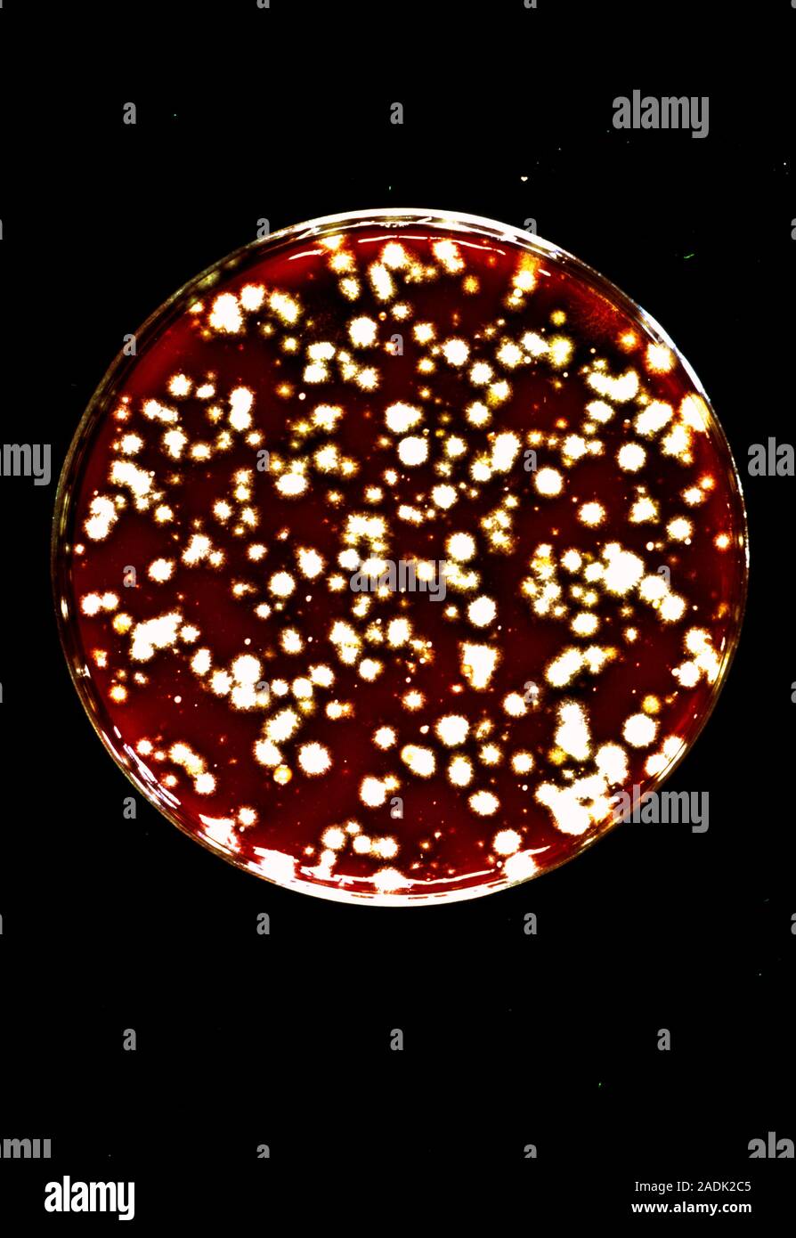 Bacterial colonies cultured on blood agar growth medium in a petri dish. Blood agar is a mixture