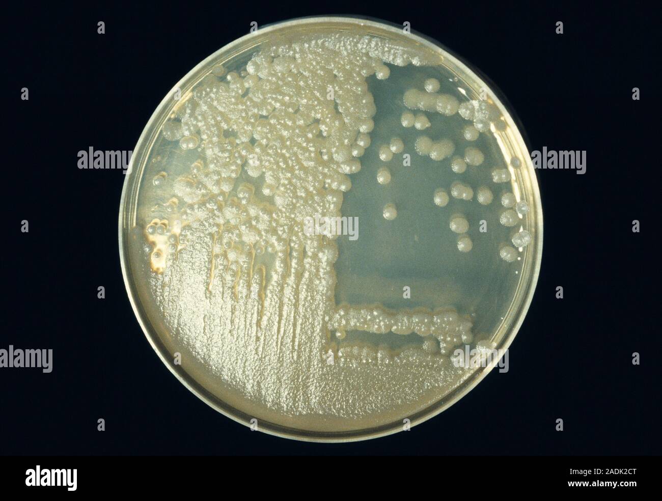 Anthrax bacteria (Bacillus anthracis) colonies (white) being cultured ...