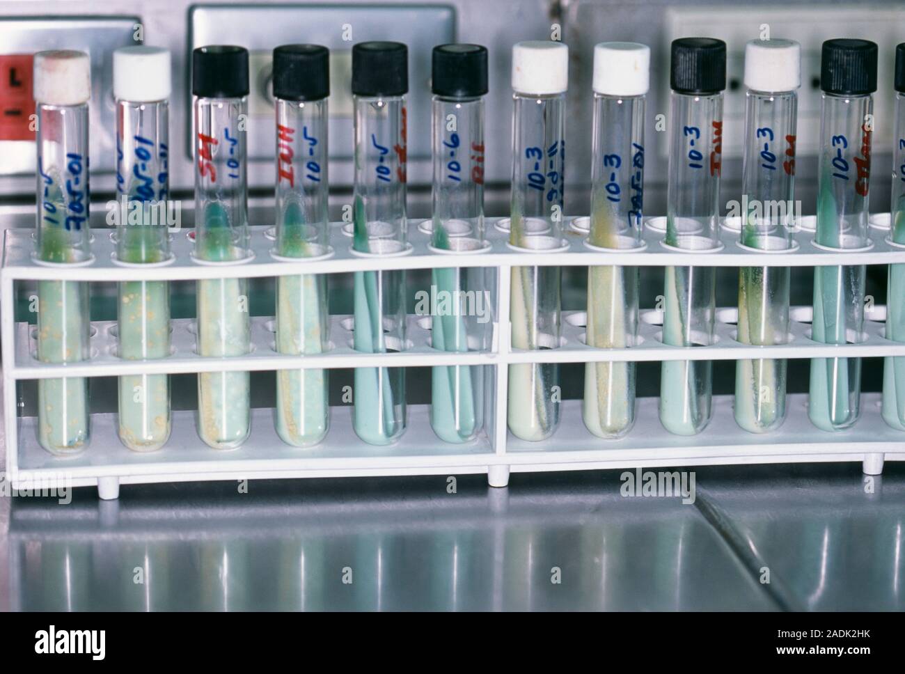 Tuberculosis research. Test tubes being used to culture tuberculosis