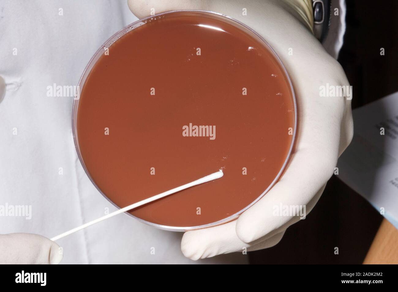 Culturing samples. Doctor rubbing a sample swab over a chocolate agar