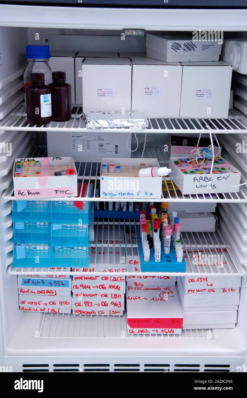 Viral research. Samples stored in a freezer at the National Reference
