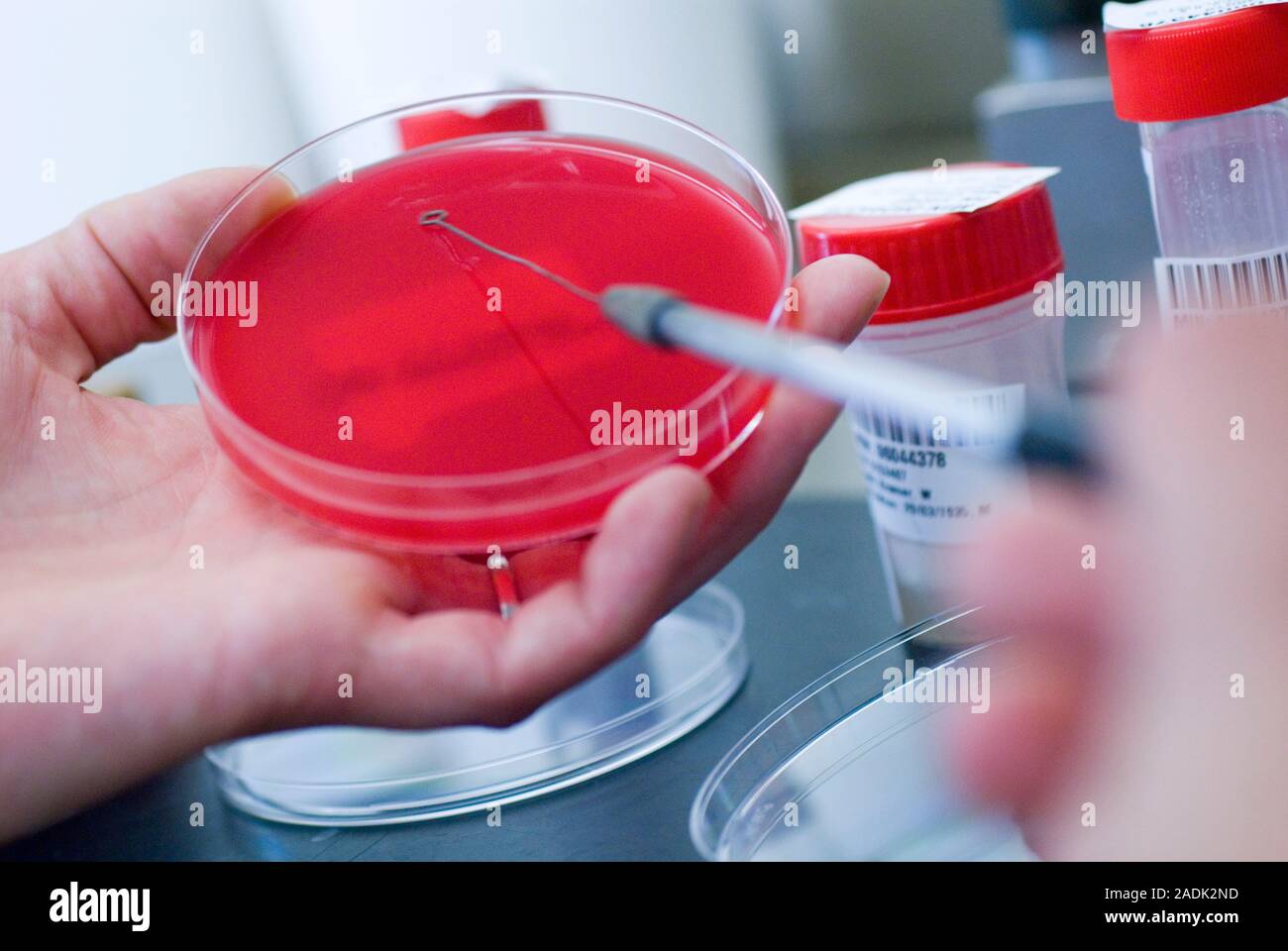 Testing sputum for lung diseases. Image 2 of 3. Researcher applying