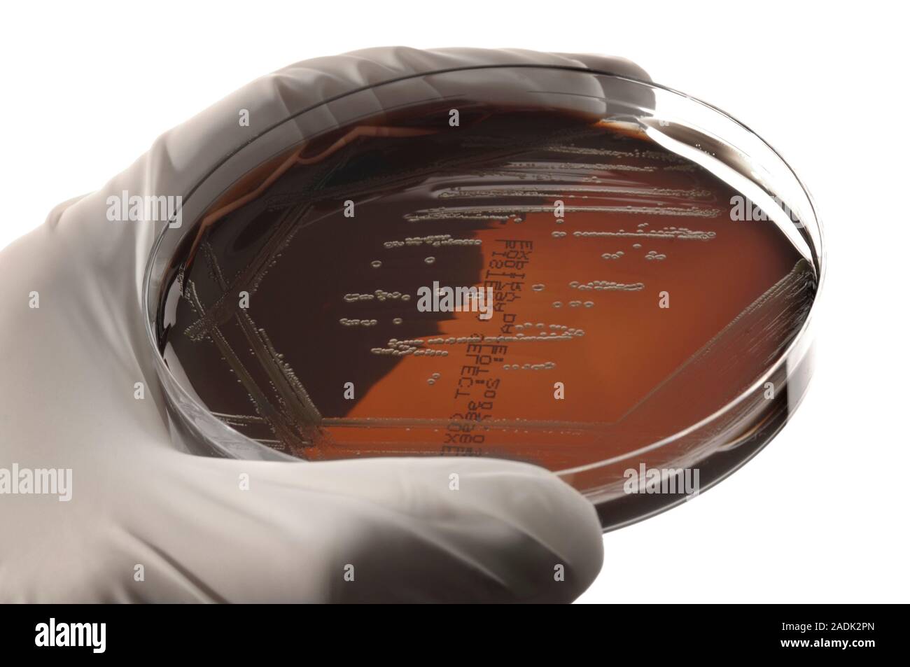 MODEL RELEASED. Listeria culture. Microbiologist holding a petri dish