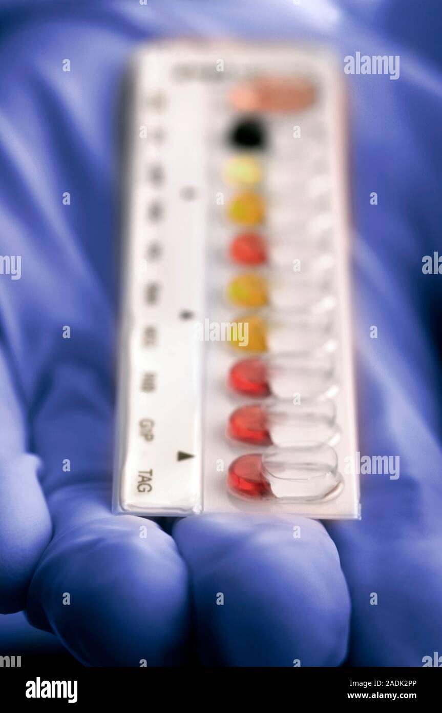 MODEL RELEASED. Listeria identification. Microbiologist holding an