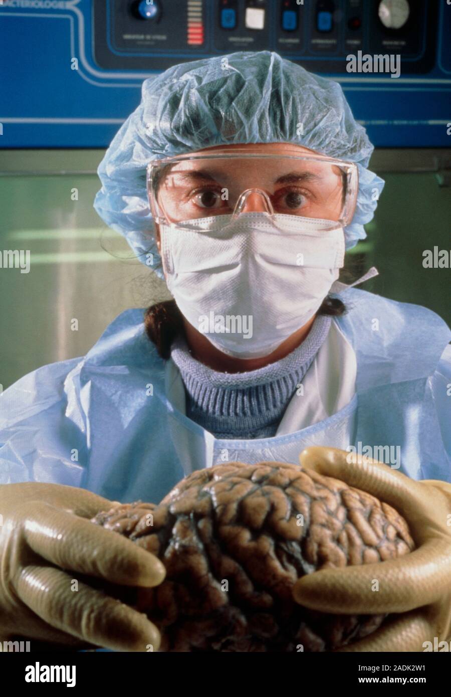 Creutzfeldt-Jakob disease test. Masked pathologist holds a human brain ...