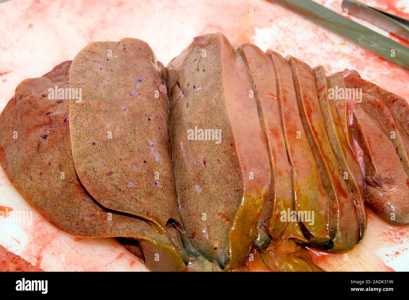 Liver, postmortem. The liver is a large abdominal organ that plays a