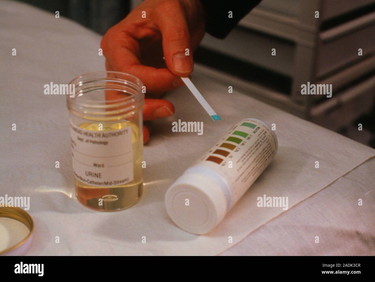 Test for glucose level in urine. The blue colouration on the end ...