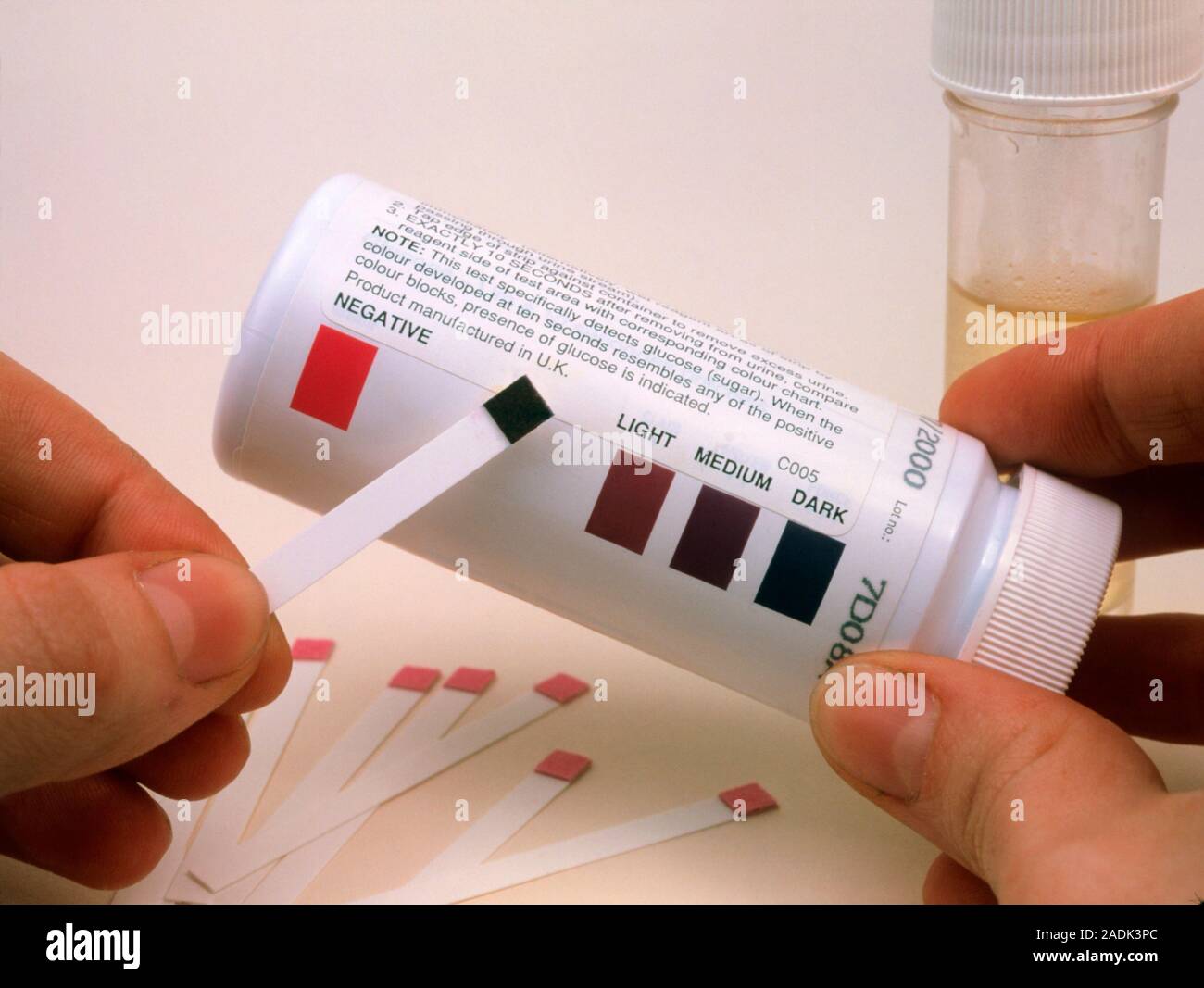 Abnormal urine glucose test. View of the hands of a general practice doctor holding a positive