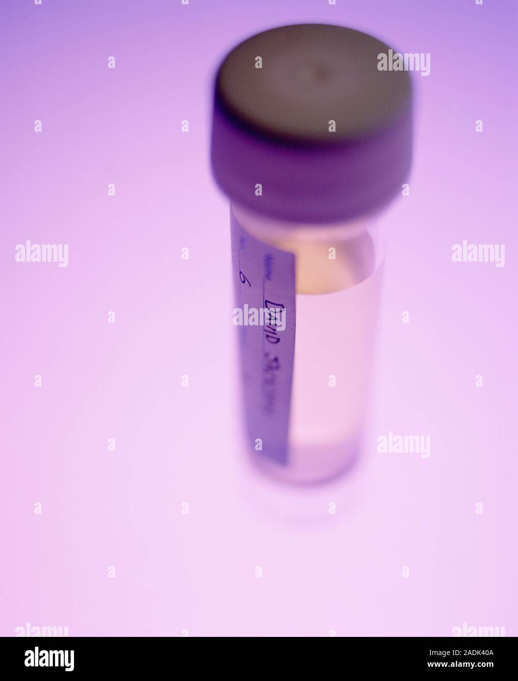 Urine sample. Sample tube containing a specimen of human urine. This