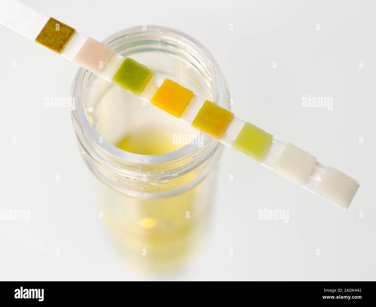 Urine analysis. Multiple test stick (Multistix) balanced on top of a