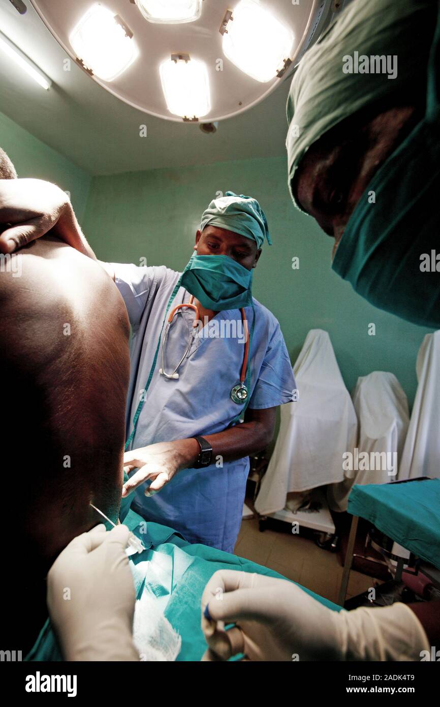 MODEL RELEASED. Epidural anaesthetic. Anaesthetist inserting a catheter