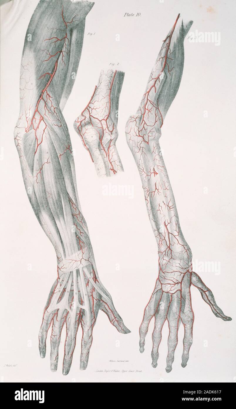 Arm arteries. Historical illustration of the arteries and muscles of ...