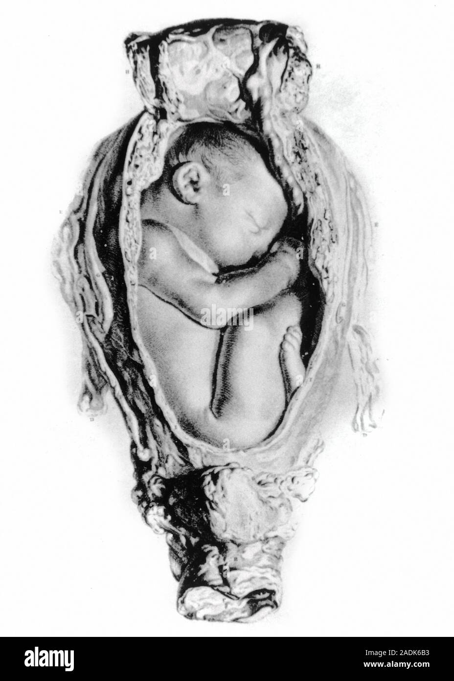 Human foetus. Drawing of a human foetus in utero, from William Hunter's