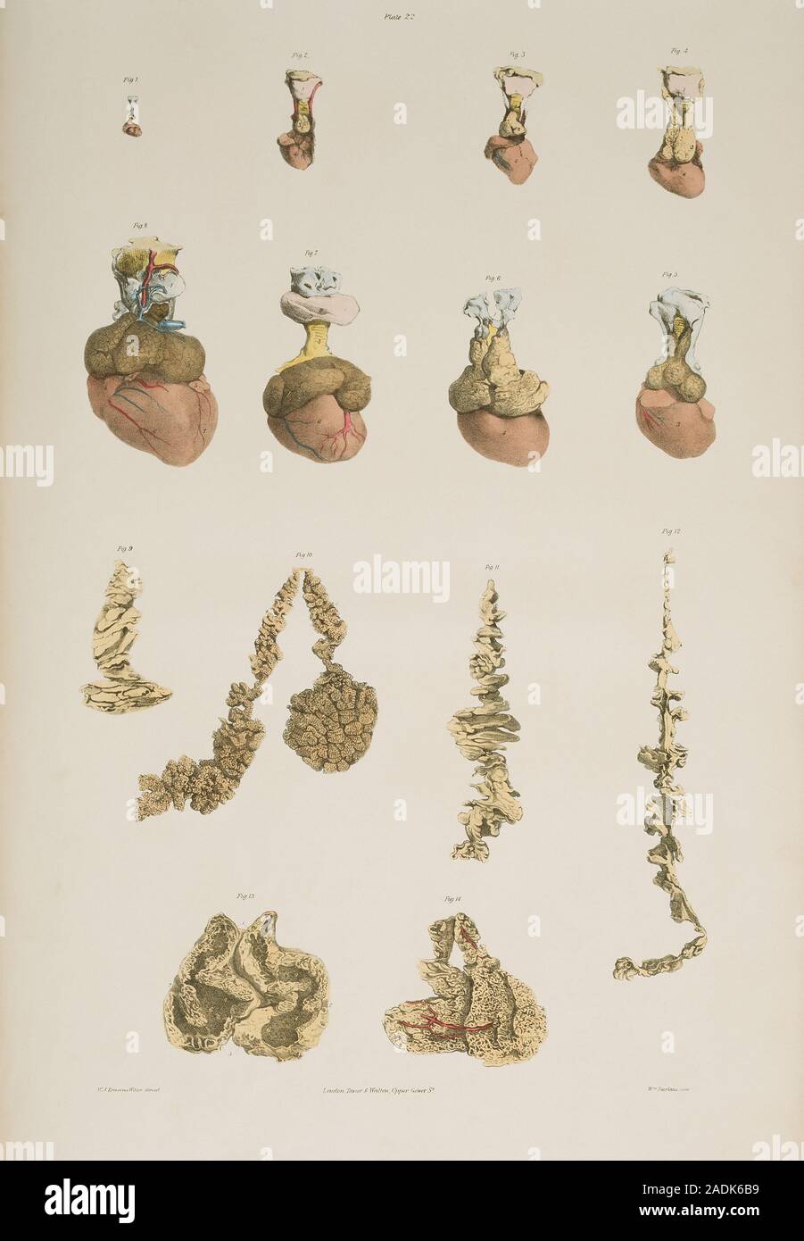 Thymus gland. Historical illustrations of the thymus gland developing from an embryonic state at