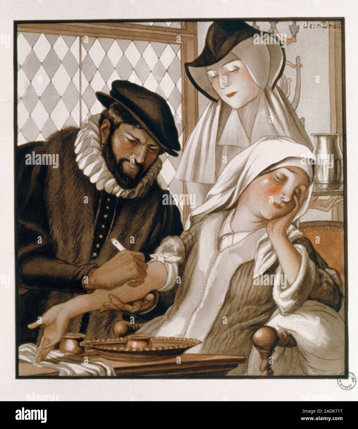 Doctor bleeding a patient. Illustration of a 16th century doctor ...