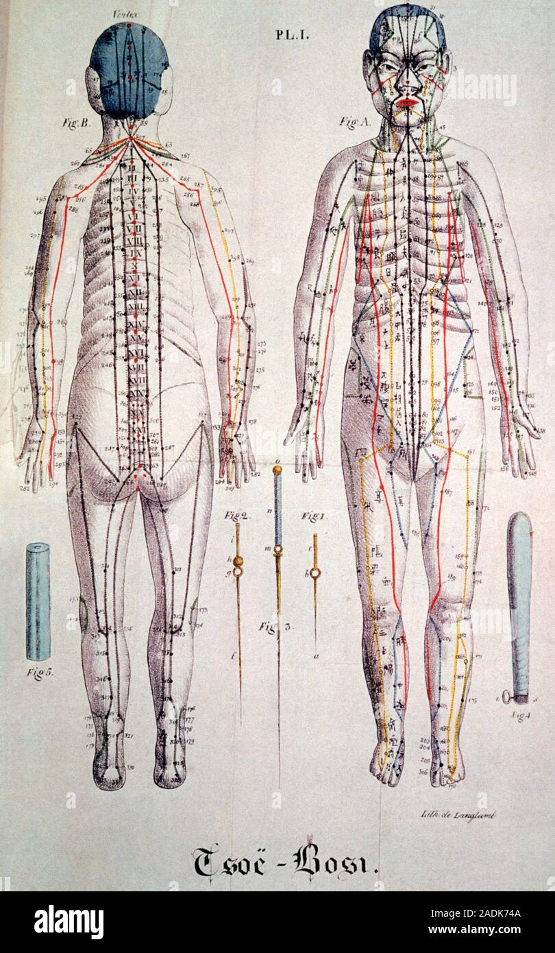 Acupuncture diagrams. Historical diagram of the acupuncture channels of