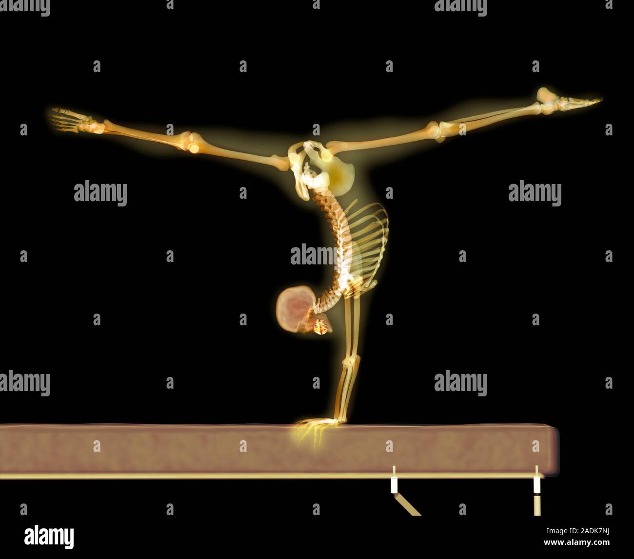 Gymnast. Enhanced Xray of a gymnast performing a split handstand on a