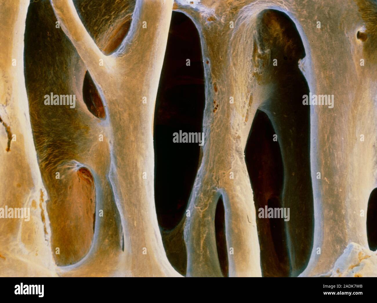 клетка кости фото