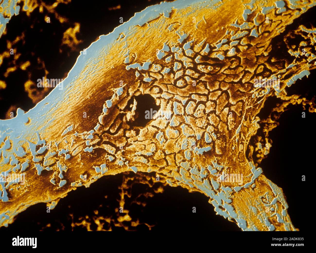 Osteoblast bone cells on a section of bone, coloured scanning electron