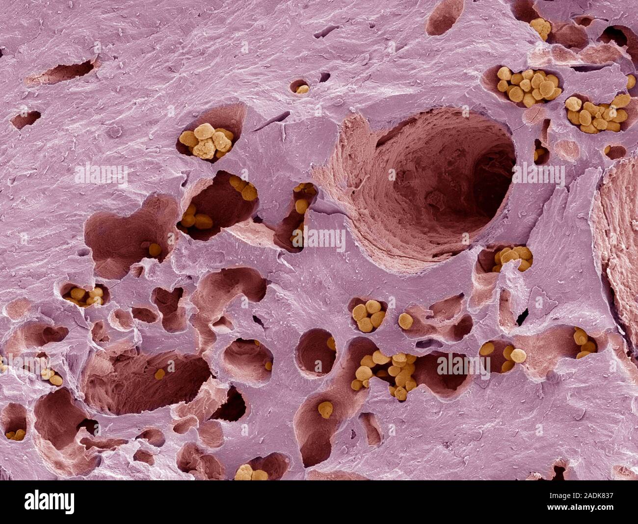 Fossilised compact bone. Coloured scanning electron micrograph (SEM) of ...