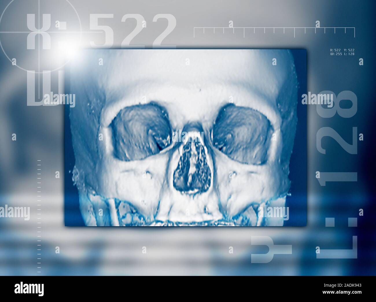 Skull Scan Human skull, 3-D computed tomography (CT) scan. The orbits of the eyes ...