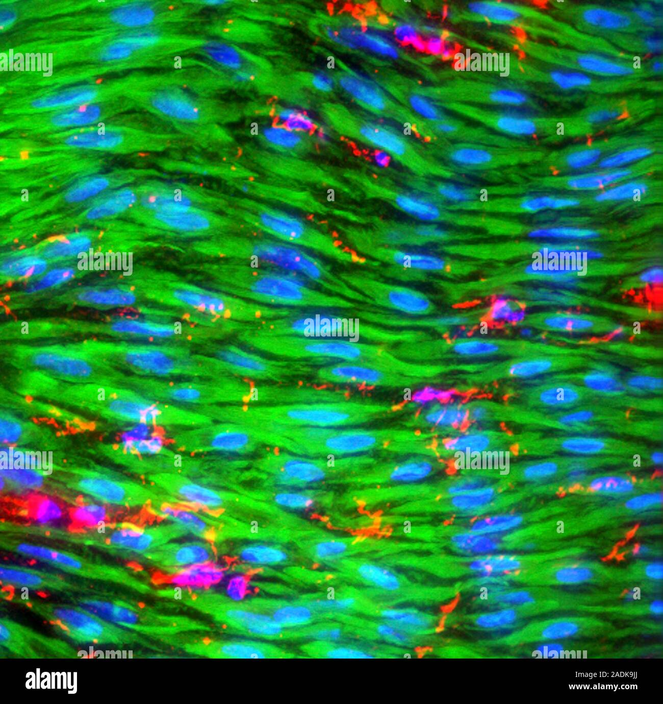 Smooth muscle cells, fluorescence deconvolution micrograph. Fluorescent