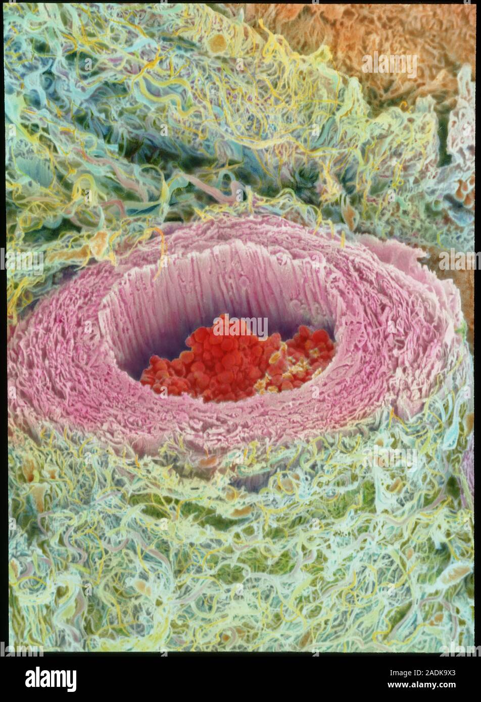 Arteriole. Coloured scanning electron micrograph (SEM) of a cross ...