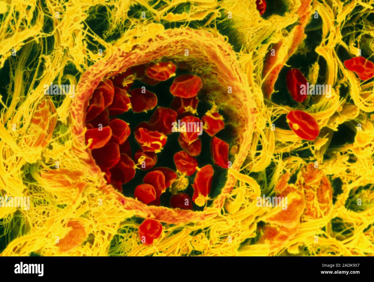Blood vessel. Coloured scanning electron micrograph (SEM) of a cross ...