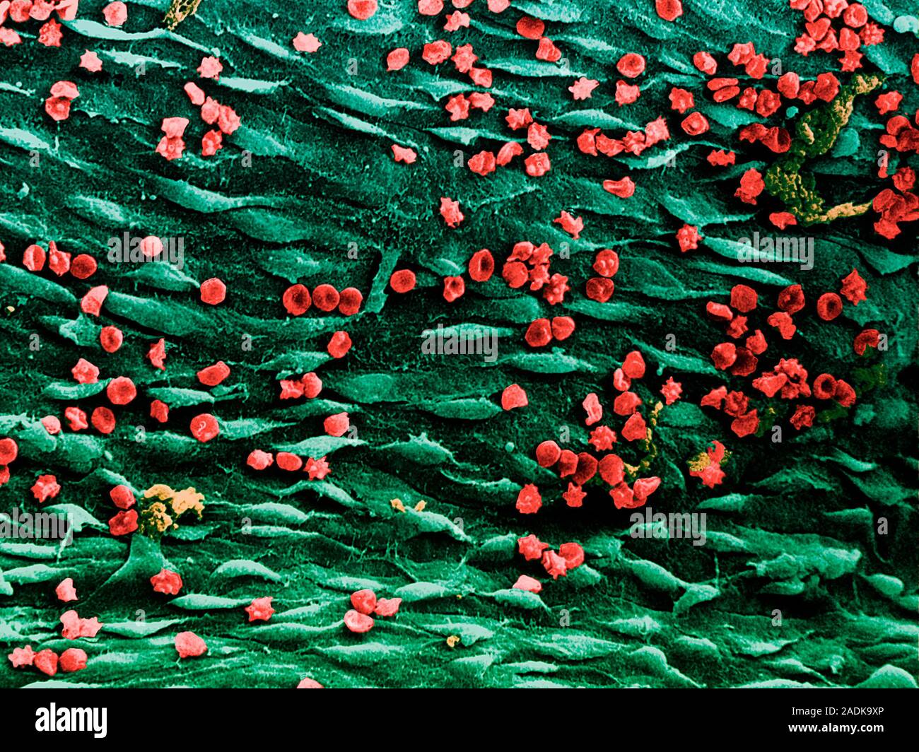 Blood vessel. Coloured scanning electron micrograph (SEM) of a ...