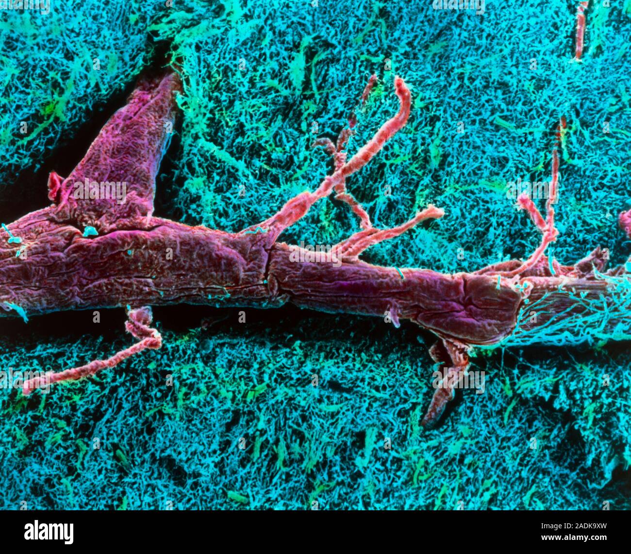 Blood vessel. Coloured scanning electron micrograph (SEM) of a blood ...