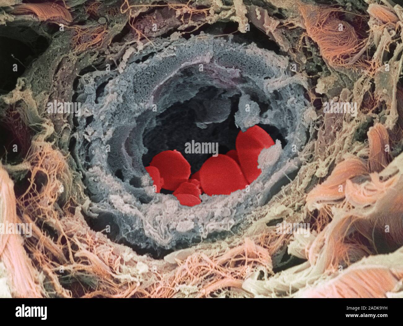 Blood vessel. Coloured scanning electron micrograph (SEM) of a section ...