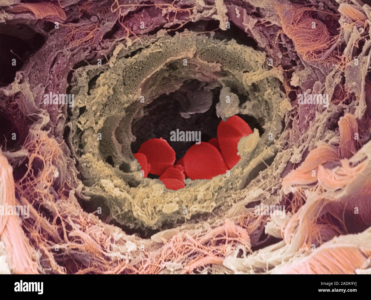 Blood vessel. Coloured scanning electron micrograph (SEM) of a section ...