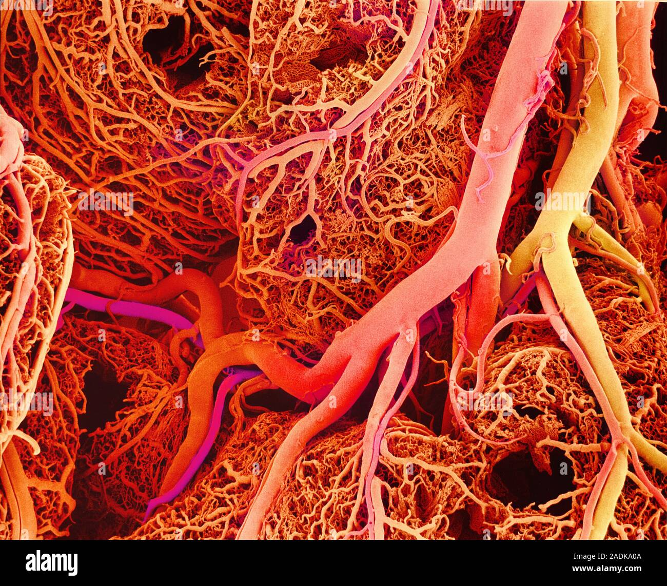 Blood vessels. Coloured scanning electron micrograph (SEM) of a resin ...