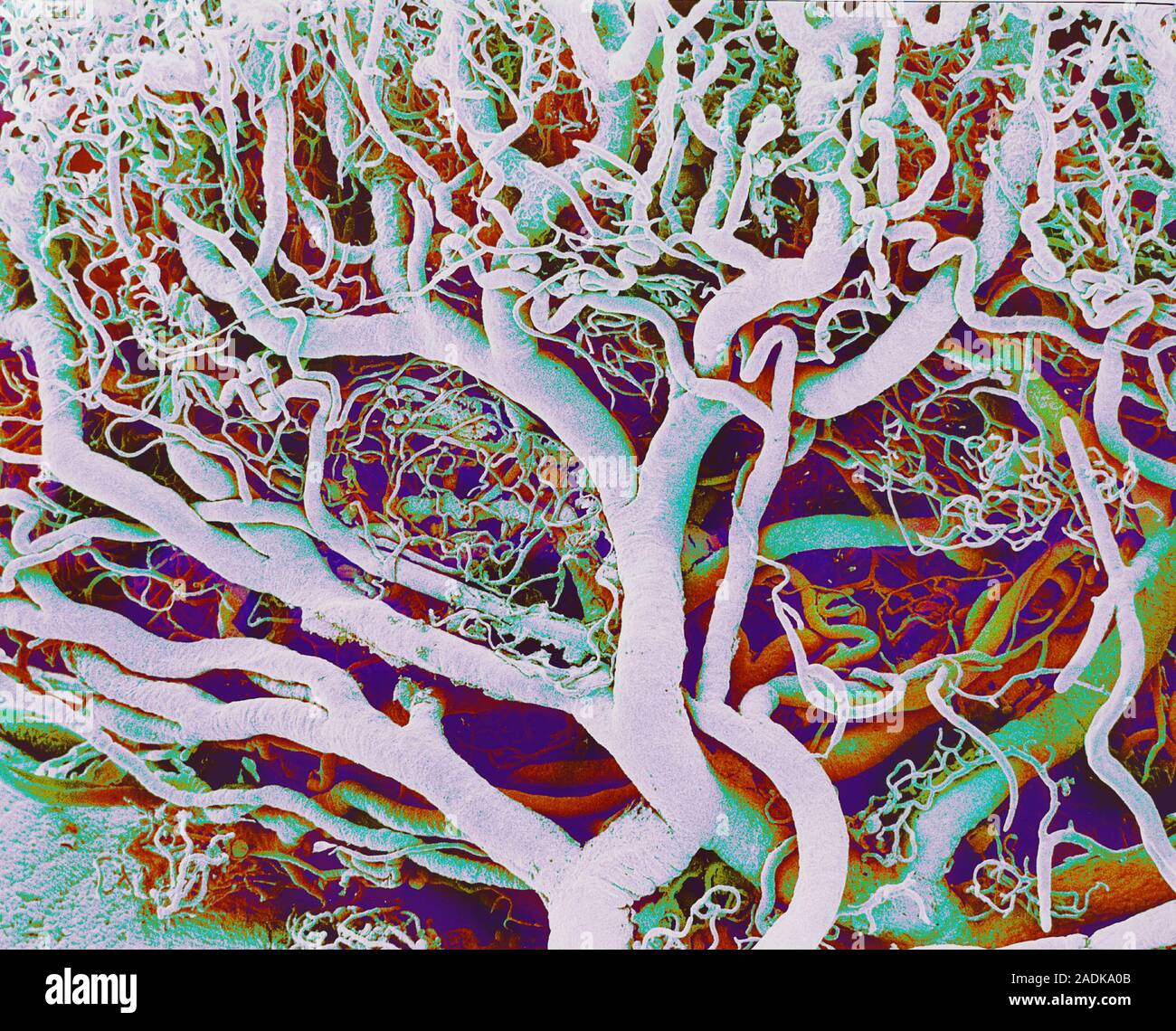 Blood vessels. Coloured scanning electron micrograph (SEM) of a resin ...