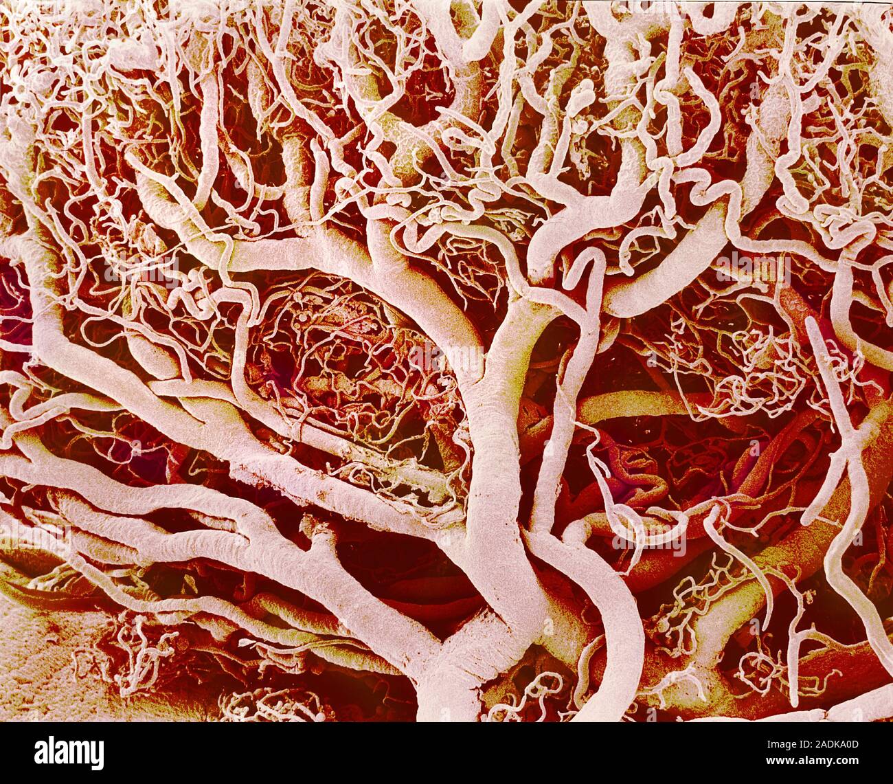 Blood vessels. Coloured scanning electron micrograph (SEM) of a resin ...