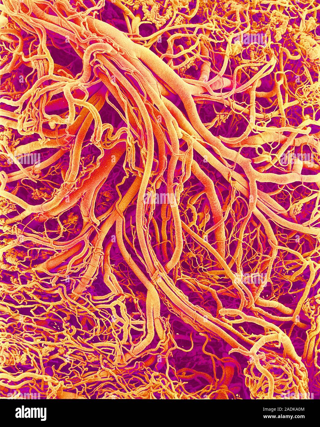 Blood vessels. Coloured scanning electron micrograph (SEM) of a resin ...