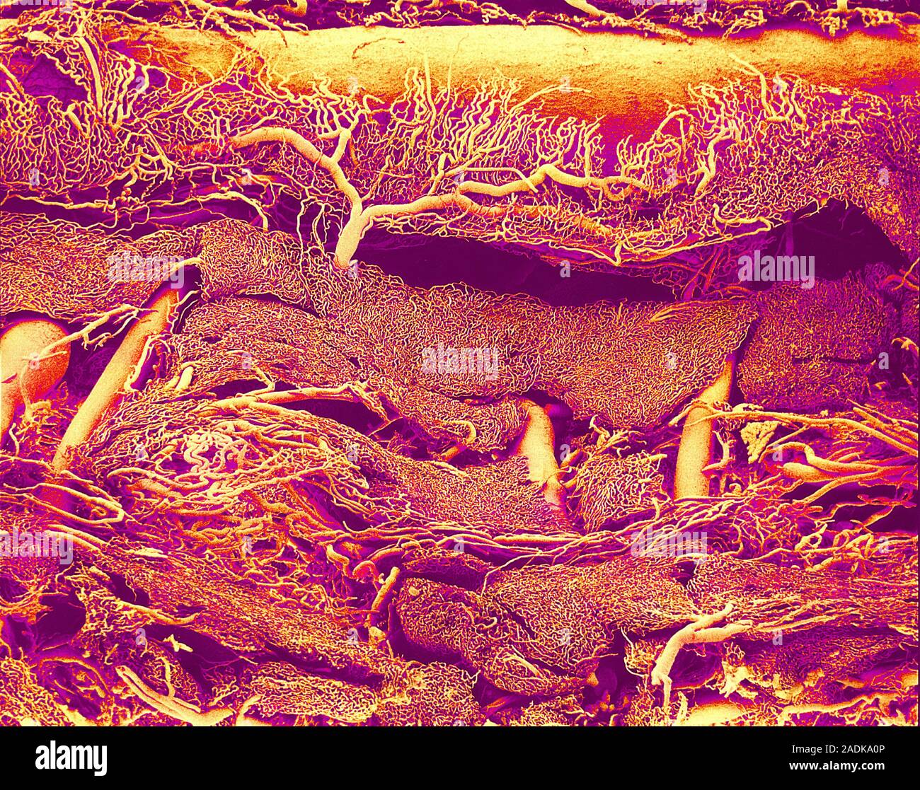 Blood vessels. Coloured scanning electron micrograph (SEM) of a resin ...