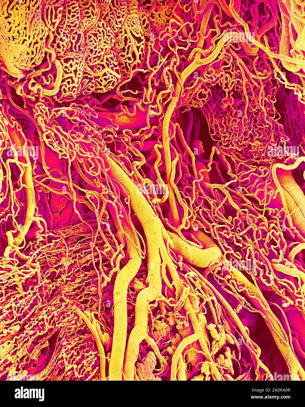 Blood vessels. Coloured scanning electron micrograph (SEM) of a resin ...