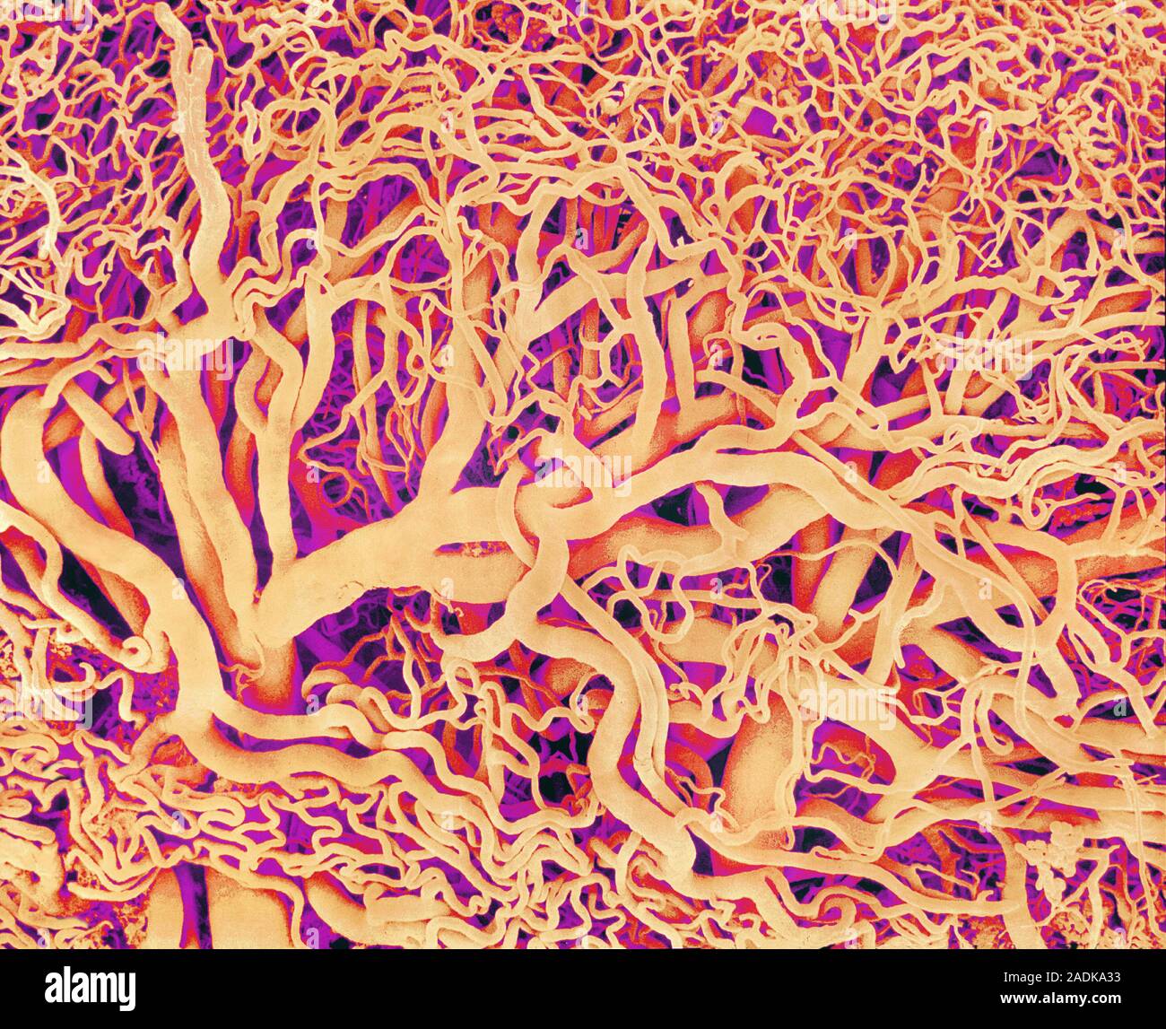 Blood vessels. Coloured scanning electron micrograph (SEM) of a resin ...